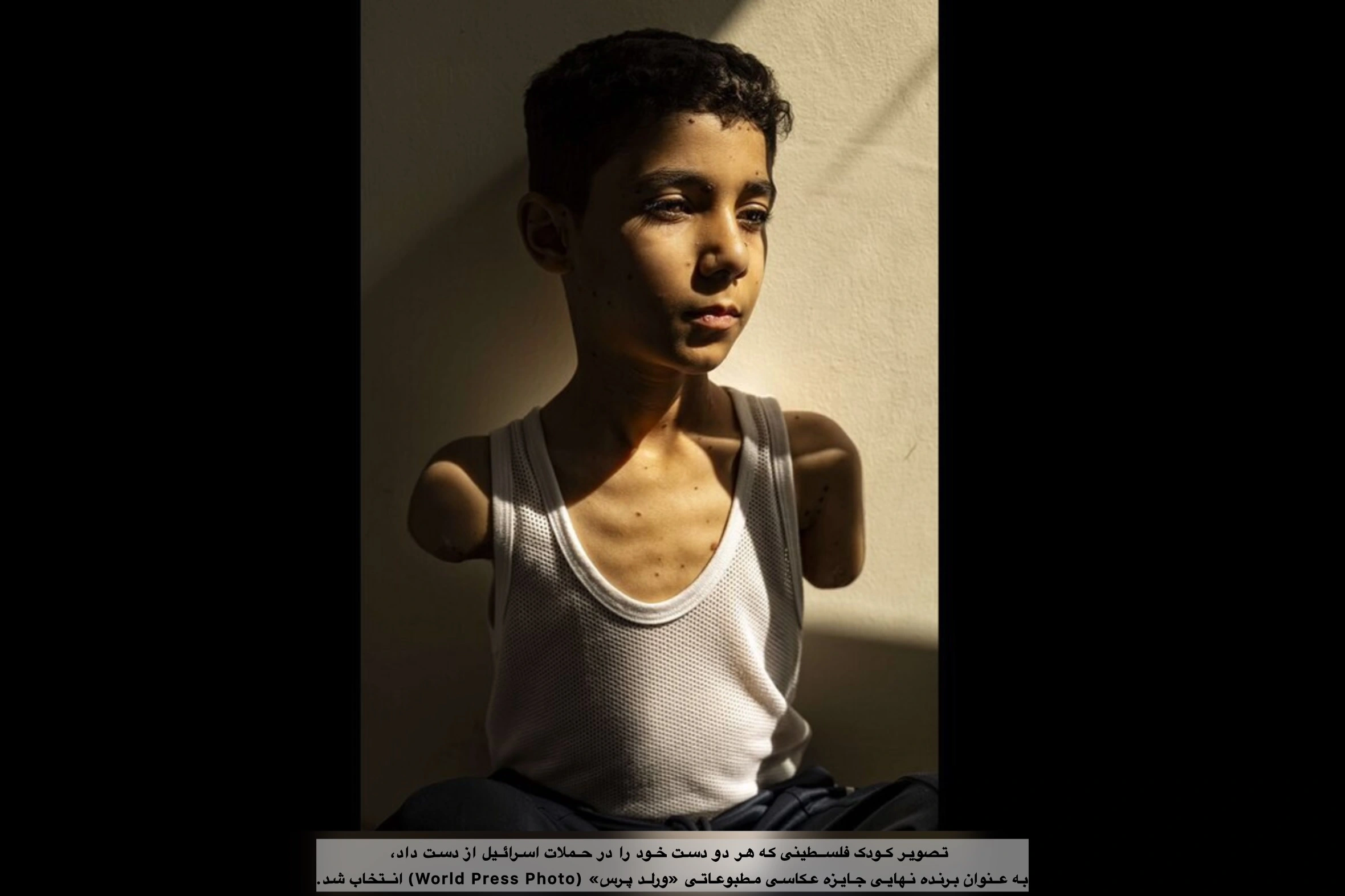 عکس کودک فلسطینی برنده جایزه عکاسی مطبوعاتی «ورلد پرس» (World Press Photo)